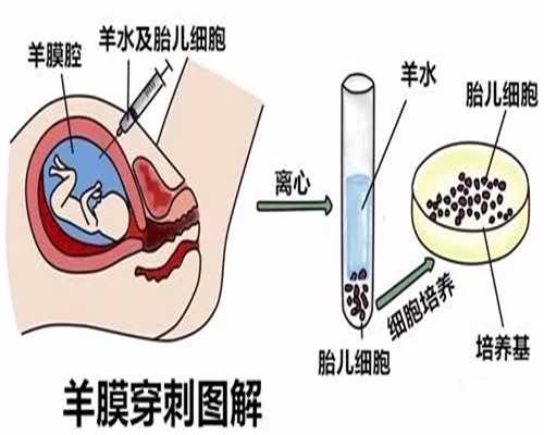 香港达雅高验血中心多少钱,苏州显微外科取精后辅助生殖助孕获成功