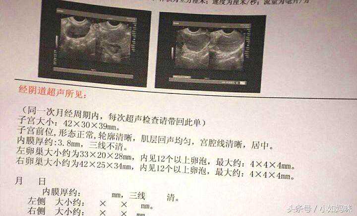 香港验血鉴定准吗,多囊，备孕一年半无果，促排一个月成功怀上双胞胎，顺利