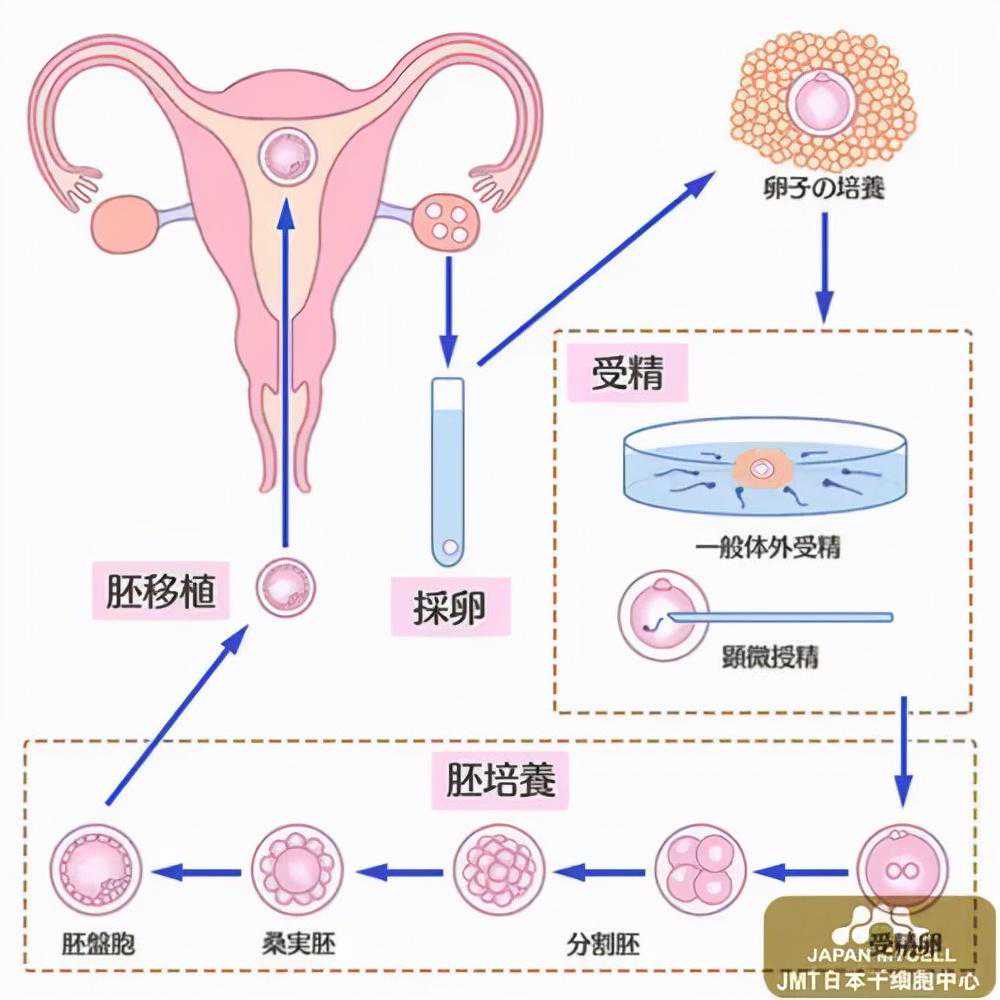 香港pg 验血报告单ve,「疾病科普」复发性流产患者适合选择辅助生殖技术助孕吗
