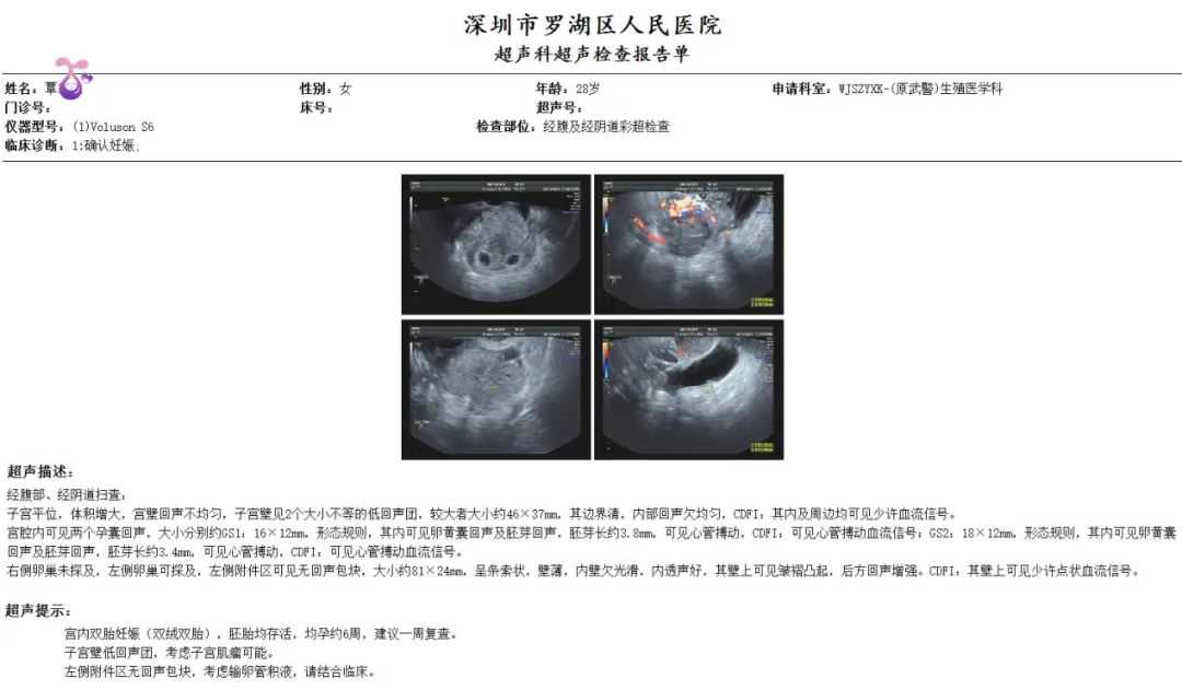 香港寄验血准吗,郑州助孕试管婴儿助孕生双胎容易吗