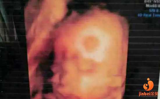 6周胚芽3mm香港验血,女性不孕